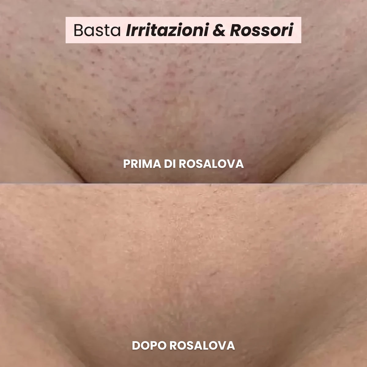 Rasoio Rosalova